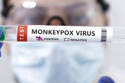 Delhi: African Woman with Travel History to Nigeria Tests Positive for Monkeypox, Tally Now at 5