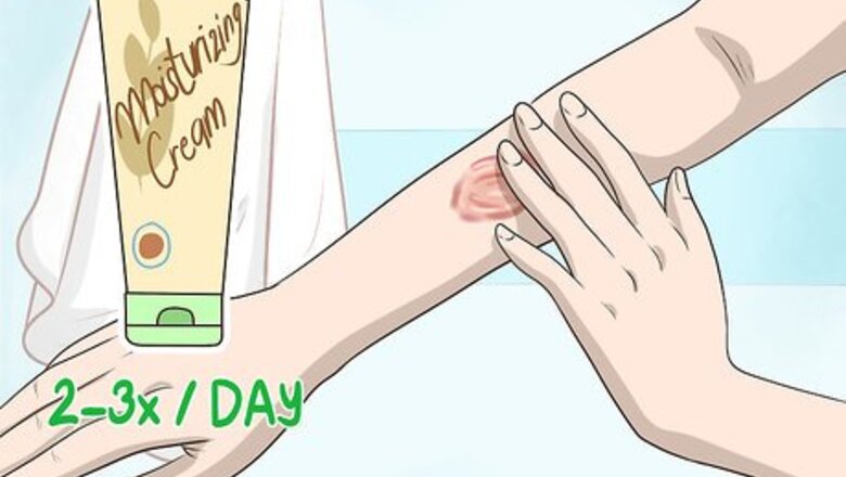 How to Get Rid of Burn Scars