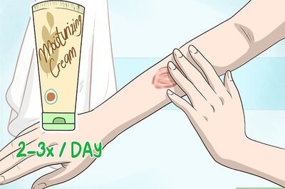 How to Get Rid of Burn Scars