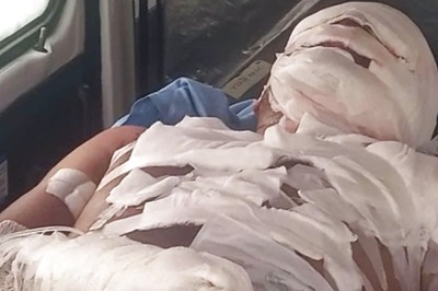 Gujarat: Newly-married Man, His 3-yr-old Nephew Injured After 'Toy' Bomb Gift Explodes; 2 Held