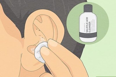 How to Remove & Prevent Blackheads in Ears