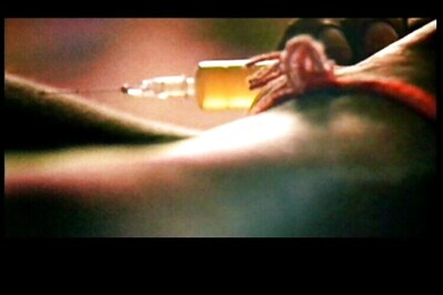 Unsafe Needle Practices Leading Cause of Hepatitis-C, Warn Doctors