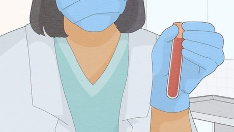 How to Prevent Hair Loss from Lupus