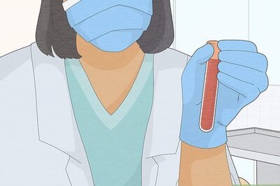 How to Prevent Hair Loss from Lupus