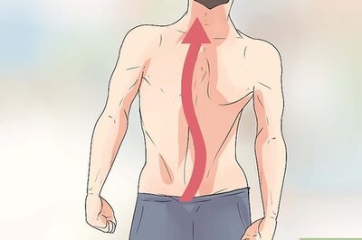 How to Treat Scoliosis