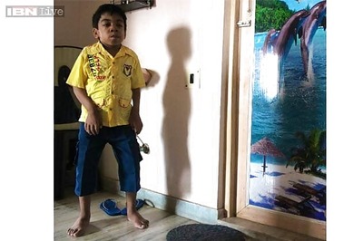 AIIMS report on Arian, suffering from Hunter Syndrome, to be submitted to Health Minister today