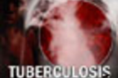 New capsule to cure tuberculosis faster
