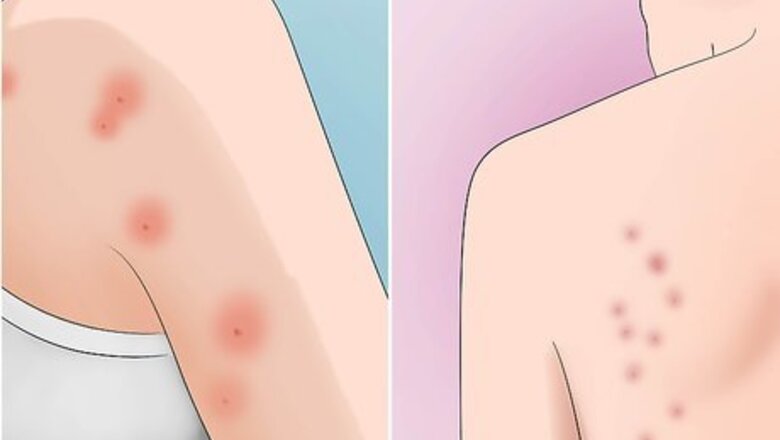 How to Avoid Insect Bites While Sleeping