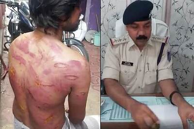 Indore Youth Beaten by Man Who Wanted to Marry His Sister