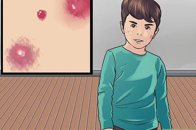 How to Recognize Skin Bacterial Infections