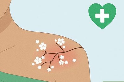 How to Get a Tattoo to Stop Itching: Tips for Fast Relief