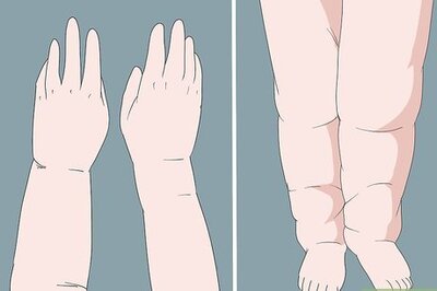 How to Treat Lymphedema