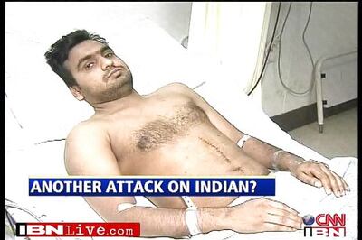 Race attack victim gets Oz residency