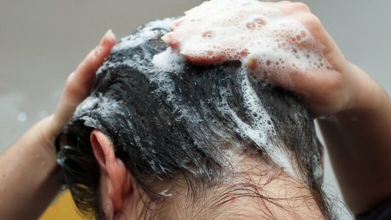 How to Treat Seborrheic Dermatitis