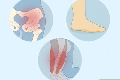 Fix Out Toeing, Straighten Your Feet, & Prevent Injury (Adults)