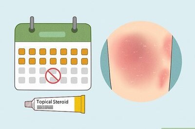Topical Steroid Withdrawal: What Causes It & How to Treat It