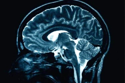 Highly Caffeinated Drinks May Affect Your Brain Like Cocaine