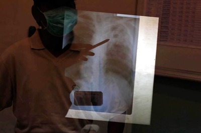 India to Roll Out Shorter Treatments for Drug Resistant Tuberculosis