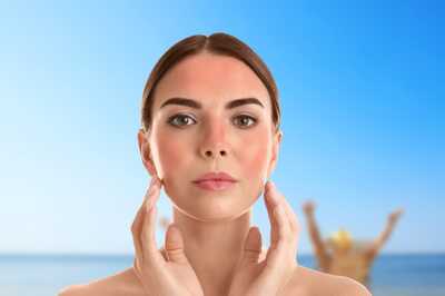 Sunburn vs Sun Poisoning: An Overview