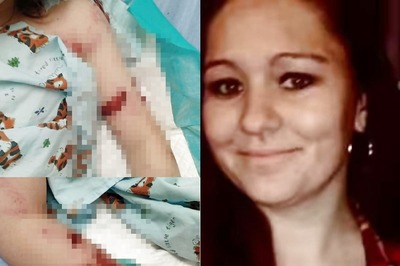 Pack Of Dogs Mauls Mother To Death In Front Of Her Children In US, Bite Elder Son’s Face, Head