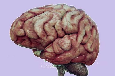 Scientists Develop 3D-Printed Brain Tissue, Opens New Dimension For Therapies