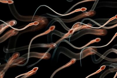 Diet High in Sugar May Affect Sperm Quality, Says Study