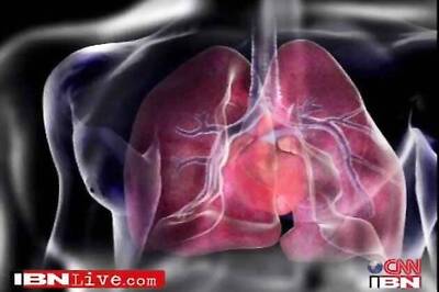 Battery less cardiac pacemaker powered by heart