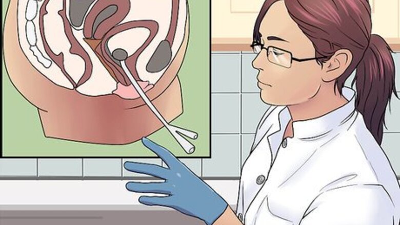How to Use a Urinary Catheter for a Female