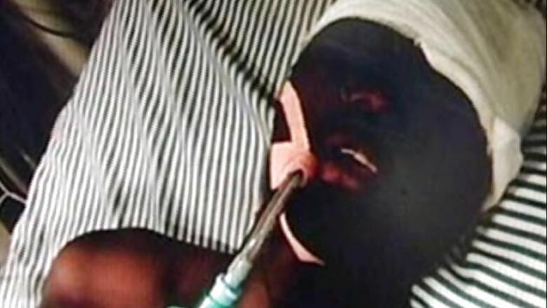 Punjab to get injured African student airlifted to Delhi