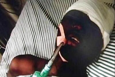 Punjab to get injured African student airlifted to Delhi