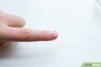 How to Fix a Broken Fingernail