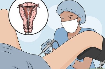 How to Remove Uterine Polyps