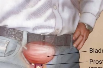 4 Types Of Cancer Likely To Affect Men Over 40