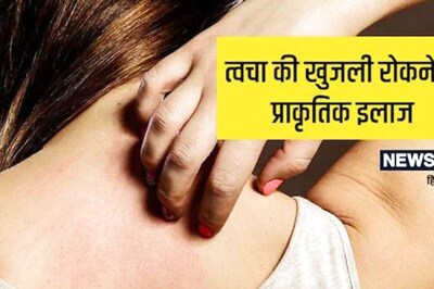 Itchy Skin? Treat It At Home With These Easy Remedies