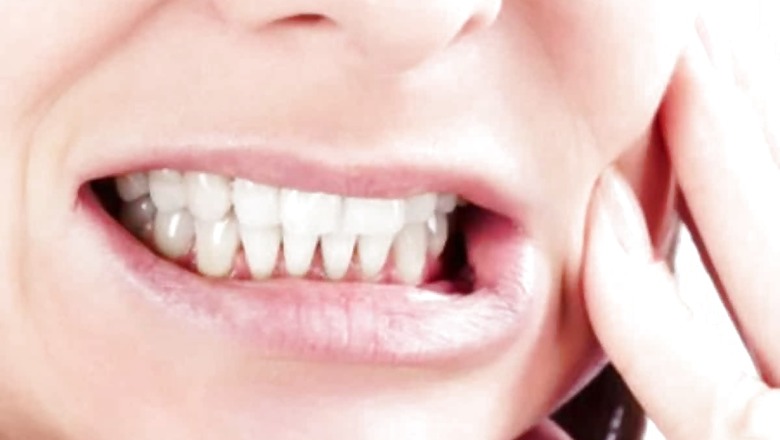 Teeth Grinding on the Rise During Pandemic: What Are the Symptoms and How to Deal with it