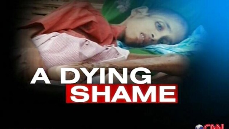 Appoint doctors in tribal areas to stop malnutrition deaths: HC to Maharashtra government