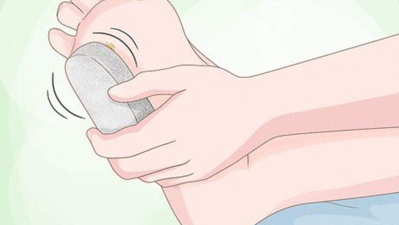 How to Treat a Wart at Home