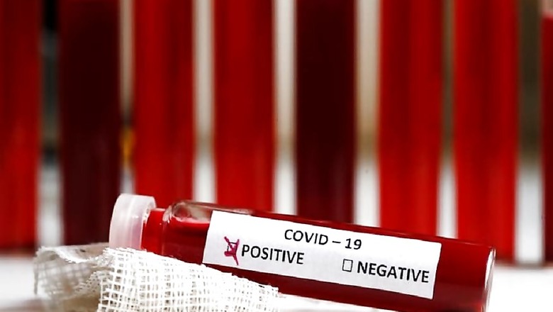 Covid-19 Pandemic: Delhi Disaster Management Authority to Discuss Capping Hospital Charges, Testing Cost