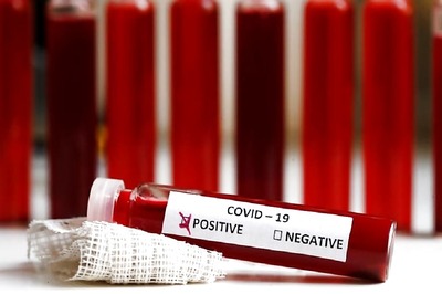 Covid-19 Pandemic: Delhi Disaster Management Authority to Discuss Capping Hospital Charges, Testing Cost