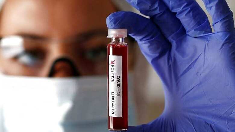 All Acute Respiratory Illness Patients Being Tested for Covid-19, 5 Lakh Probes Have Arrived From US: Govt