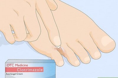 How to Get Rid of Foot Fungus
