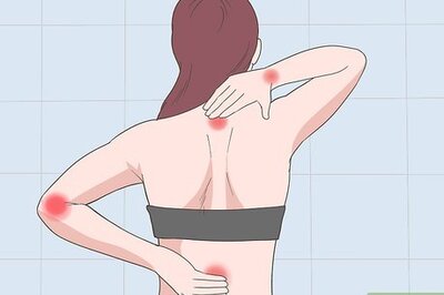 How to Treat a Pinched Nerve