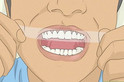 How to Get Whiter Teeth at Home