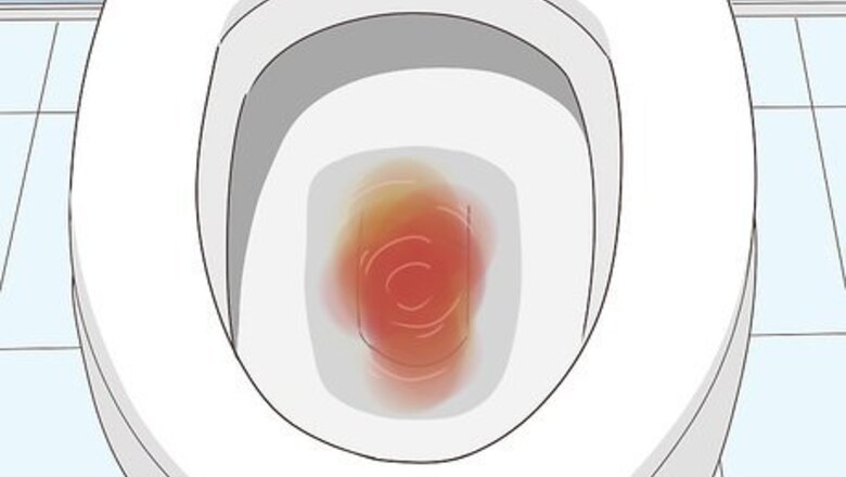 How to Diagnose Bladder Cancer