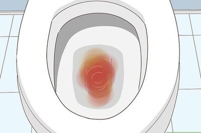 How to Diagnose Bladder Cancer