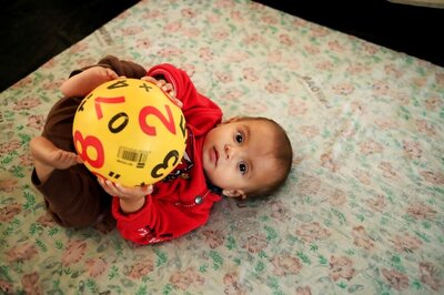 India Had Second Highest Obese Children In 2015: Study