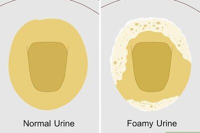 Foamy Urine: Causes, Treatments, & When to See a Doctor