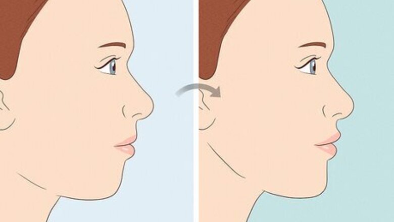 Facial Forward Growth—Exploring the TikTok Trend