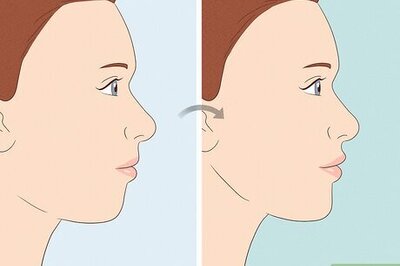 Facial Forward Growth—Exploring the TikTok Trend