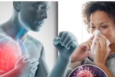 Influenza Needs Symptomatic Treatment Instead Of Antibiotics And Long Term Cough Syrups